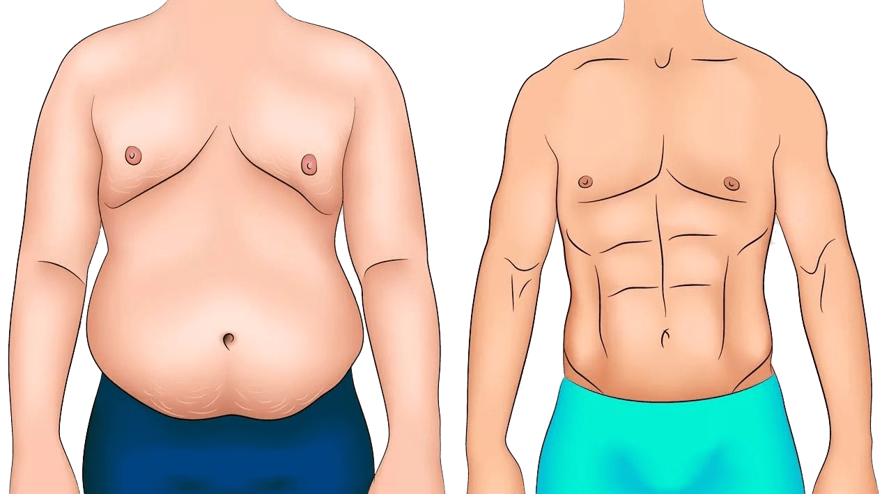 How to remove the abdomen