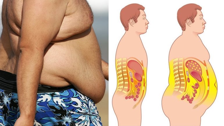 Как убрать живот мужчине: почему у мужчин появляется жир на животе и как от  него быстро избавиться? Мнение экспертов. Спорт-Экспресс